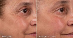 Medik8's £27 anti-ageing cream hailed 'incredible' for 'smoothing out fine lines'