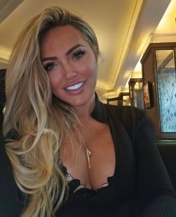 Channel 4 star rushed to hospital as XL Bully attack leaves her 'scarred for life'