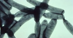 NYC launches emergency response after almost 50 infected with disease outbreak
